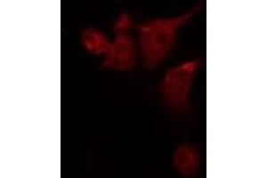 ABIN6276009 staining 293T by IF/ICC. (G Protein-Coupled Receptor 133 Antikörper)
