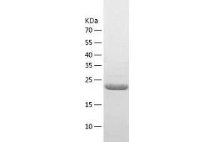 Western Blotting (WB) image for Linker For Activation of T Cells Family, Member 2 (LAT2) (AA 27-243) protein (His tag) (ABIN7288743) (LAT2 Protein (AA 27-243) (His tag))