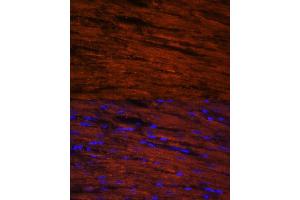 Immunofluorescence (IF) image for anti-LIM Domain Binding 3 (LDB3) (AA 1-283) antibody (ABIN6143125)