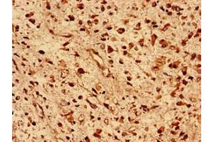 Immunohistochemistry (IHC) image for anti-DnaJ (Hsp40) Homolog, Subfamily B, Member 5 (DNAJB5) (AA 1-344) antibody (ABIN7150524)