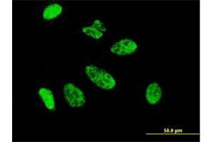 Immunofluorescence of monoclonal antibody to CDX1 on HeLa cell.