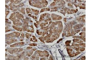 Image no. 1 for anti-Carboxypeptidase B1 (Tissue) (CPB1) (AA 14-418) antibody (ABIN598622) (CPB1 Antikörper  (AA 14-418))