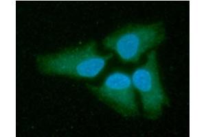 ICC/IF analysis of LDHB in HeLa cells line, stained with DAPI (Blue) for nucleus staining and monoclonal anti-human LDHB antibody (1:100) with goat anti-mouse IgG-Alexa fluor 488 conjugate (Green).