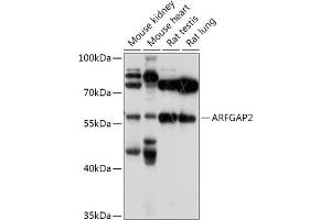 Western blot analysis of extracts of various cell lines, using  antibody (ABIN7265486) at 1:1000 dilution. (arfgap2 Antikörper  (AA 242-521))