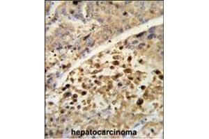 Immunohistochemistry (Paraffin-embedded Sections) (IHC (p)) image for anti-Nuclear Receptor Subfamily 1, Group I, Member 2 (NR1I2) (AA 100-127) antibody (ABIN652618)