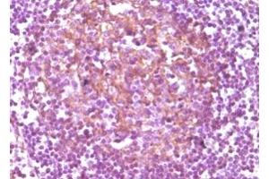 Immunohistochemistry (IHC) image for anti-CD14 (CD14) antibody (ABIN2464028) (CD14 Antikörper)