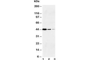 Western blot testing of Caspase-1 antibody and Lane 1:  Jurkat;  2: Raji;  3: CEM (Caspase 1 Antikörper  (Large Subunit, N-Term))