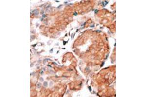 Image no. 1 for anti-Guanylate Cyclase Activator 1A (Retina) (GUCA1A) (C-Term) antibody (ABIN357117)