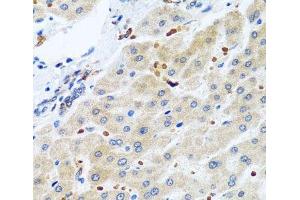 Immunohistochemistry of paraffin-embedded Human liver using RGS5 Polyclonal Antibody at dilution of 1:100 (40x lens). (RGS5 Antikörper)