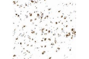 Immunocytochemistry (ICC) image for anti-Tyrosine Hydroxylase (TH) (AA 450-500) antibody (ABIN7449433) (Rekombinanter Tyrosine Hydroxylase Antikörper  (AA 450-500))