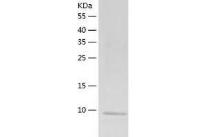 Western Blotting (WB) image for Cystatin A (Stefin A) (CSTA) (AA 1-98) protein (His-IF2DI Tag) (ABIN7122548)