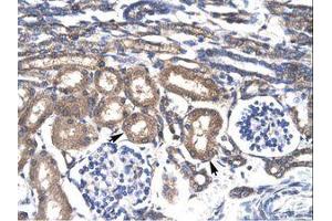 Image no. 2 for anti-Kruppel-Like Factor 8 (KLF8) (AA 89-138) antibody (ABIN6735825)