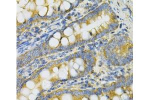 Immunohistochemistry of paraffin-embedded Rat intestine using PGK1 Polyclonal Antibody at dilution of 1:100 (40x lens). (PGK1 Antikörper)