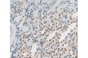 Used in DAB staining on fromalin fixed paraffin- embedded Kidney tissue (YAF2 Antikörper  (AA 1-180))