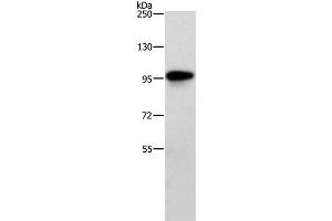 Western Blot analysis of Human brain malignant glioma tissue using TRAF3IP1 Polyclonal Antibody at dilution of 1:500