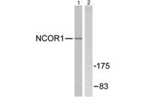 Western blot analysis of extracts from MDA-MB-435 cells, using NCoR1 Antibody. (NCOR1 Antikörper  (AA 51-100))