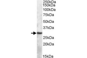 APOBEC1 polyclonal antibody  (1 ug/mL) staining of mouse spleen lysate (35 ug protein in RIPA buffer). (APOBEC1 Antikörper)