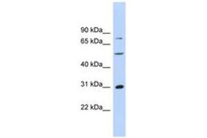 Image no. 1 for anti-Aspartate beta-Hydroxylase (ASPH) (AA 287-336) antibody (ABIN6744502) (Aspartate beta Hydroxylase Antikörper  (AA 287-336))