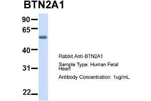 Host:  Rabbit  Target Name:  BTN2A1  Sample Type:  Human Fetal Heart  Antibody Dilution:  1.