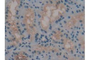 Immunohistochemistry (IHC) image for anti-Renin (REN) (AA 67-153) antibody (ABIN7432865)