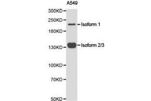 Western Blotting (WB) image for anti-Tet Methylcytosine Dioxygenase 2 (TET2) antibody (ABIN1875061) (TET2 Antikörper)