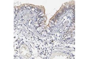 Immunohistochemical staining (Formalin-fixed paraffin-embedded sections) of human bronchus with DNAL4 polyclonal antibody  shows moderate positivity in cilia of respiratory epithelial cells. (DNAL4 Antikörper)