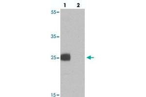 Western blot analysis of EMX1 in rat liver tissue with EMX1 polyclonal antibody  at 1 ug/mL in (lane 1) the absence and (lane 2) the presence of blocking peptide. (EMX1 Antikörper  (N-Term))