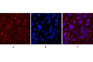 Immunofluorescence analysis of human breast cancer tissue. (Caspase 1 Antikörper  (Cleaved-Asp210))
