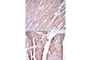 Immunohistochemical analysis of paraffin-embedded human cardiac muscle tissue (A) and striated muscle tissue (B) using TNNI2 monoclonal antobody, clone 2F12A8  with DAB staining. (TNNI2 Antikörper)
