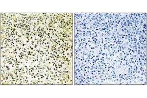 Immunohistochemistry analysis of paraffin-embedded human tonsil tissue, using NPM (Ab-234) Antibody. (NPM1 Antikörper  (AA 201-250))