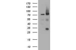 Image no. 1 for anti-Receptor (TNFRSF)-Interacting serine-threonine Kinase 1 (RIPK1) (AA 133-422) antibody (ABIN1490912) (RIPK1 Antikörper  (AA 133-422))