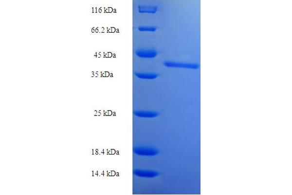 SSX2 Protein (AA 1-188, full length) (His-SUMO Tag)
