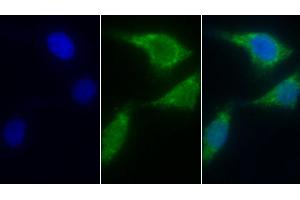 Detection of AIF in Human Hela cell using Polyclonal Antibody to Apoptosis Inducing Factor (AIF) (AIF Antikörper  (AA 103-322))