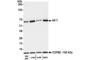 Western Blotting (WB) image for anti-V-Akt Murine Thymoma Viral Oncogene Homolog 1 (AKT1) (AA 100-150) antibody (ABIN7795633) (Rekombinanter AKT1 Antikörper  (AA 100-150))