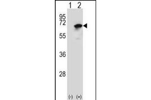 Western blot analysis of NARS (arrow) using rabbit polyclonal NARS Antibody (N-term) (ABIN655041 and ABIN2844672). (NARS Antikörper  (N-Term))