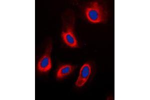 Immunofluorescent analysis of Caspase 3 staining in HeLa cells. (Caspase 3 Antikörper  (Center))