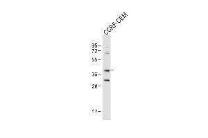 Anti-Mouse Nkx2-5 Antibody (Center) at 1:1000 dilution + CCRF-CEM whole cell lysate Lysates/proteins at 20 μg per lane.