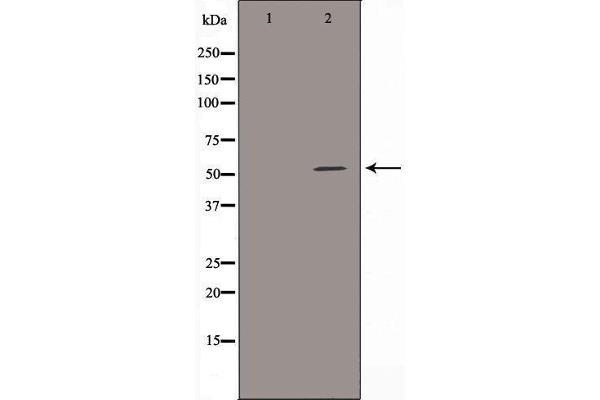 ALDH3B1 Antikörper  (N-Term)