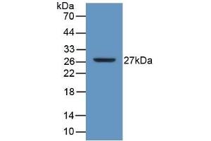 Detection of Recombinant ATP1b3, Human using Polyclonal Antibody to Sodium/potassium Transporting ATPase Subunit Beta-3 (ATP1b3) (ATP1B3 Antikörper  (AA 61-273))