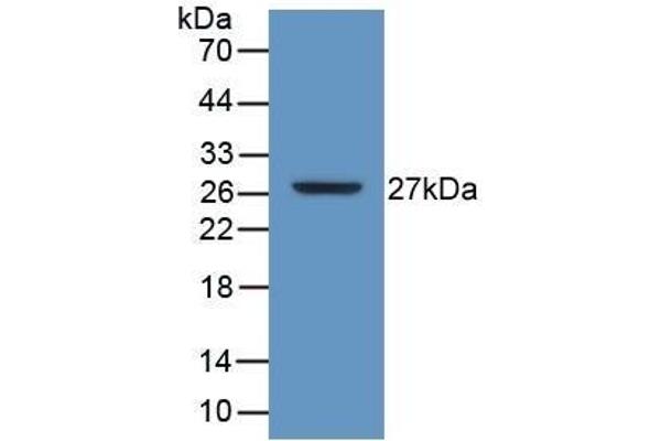 ATP1B3 Antikörper  (AA 61-273)