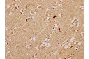 IHC image of ABIN7157259 diluted at 1:200 and staining in paraffin-embedded human brain tissue performed on a Leica BondTM system. (KBTBD7 Antikörper  (AA 475-684))