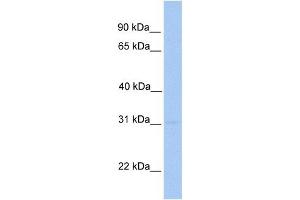 MMD2 antibody used at 1 ug/ml to detect target protein. (MMD2 Antikörper  (N-Term))