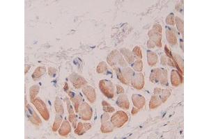 Used in DAB staining on fromalin fixed paraffin- embedded skin tissue (GSTT1 Antikörper  (AA 7-231))