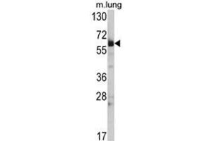 Western blot analysis of Hsp 60 Antibody (N-term) in mouse lung tissue lysates (35ug/lane). (HSPD1 Antikörper  (N-Term))