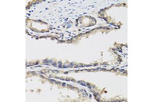 Immunohistochemistry of paraffin-embedded human prostate using PLA2G7 antibody.
