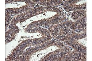 Image no. 5 for anti-Mitogen-Activated Protein Kinase Kinase 1 (MAP2K1) antibody (ABIN1499394) (MEK1 Antikörper)