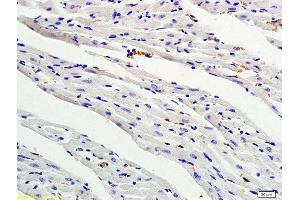 Formalin-fixed and paraffin embedded rat myocardium tissue labeled with Anti- PDGF-BB Polyclonal Antibody, Unconjugated (ABIN674874) followed by conjugation to the secondary antibody and DAB staining (PDGF-BB Homodimer (AA 151-241) Antikörper)