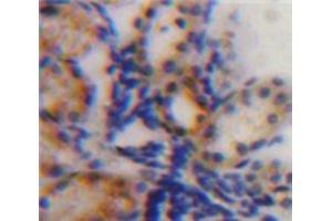 Immunohistochemistry (IHC) image for anti-Insulin-Like Growth Factor Binding Protein 2, 36kDa (IGFBP2) (AA 35-304) antibody (ABIN1172091)