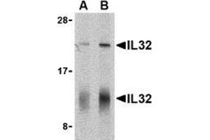 Western blot analysis of IL-32 in human spleen cell lysate with AP30424PU-N IL-32 antibody at (A) 5 and (B) 10 μg/ml shows two isoforms of IL-32.