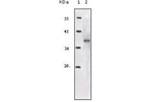 Western blot analysis using IGF1R mouse mAb against truncated IGF1R recombinant protein. (IGF1R Antikörper)